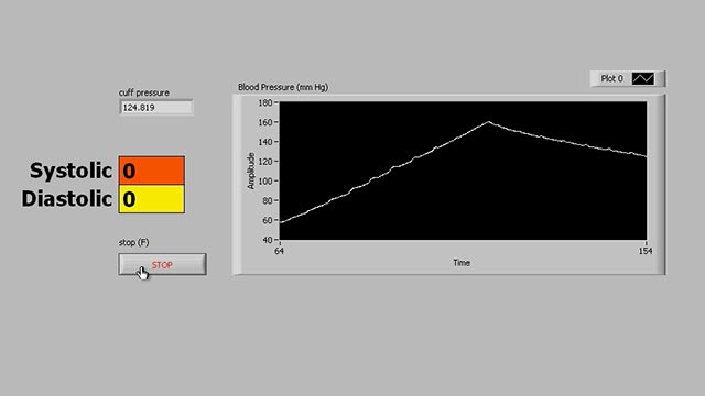 Blood Pressure Challenge Project