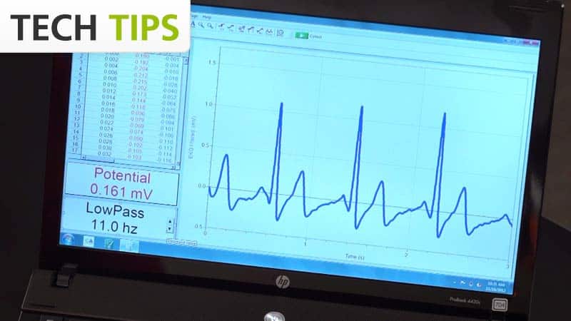 EKG Traces, Advanced Guide - Tech Tips